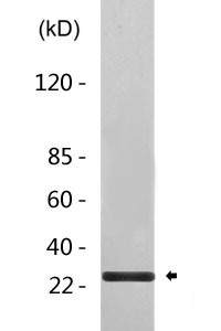 p27 (phospho Ser10) Polyclonal Antibody