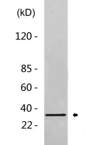 C/EBP β (phospho Thr235) Polyclonal Antibody