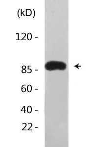 IKKα (phospho Thr23) Polyclonal Antibody