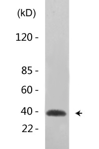 Crk-L (phospho Tyr207) Polyclonal Antibody