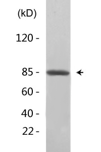 Catenin-β (phospho Ser33) Polyclonal Antibody