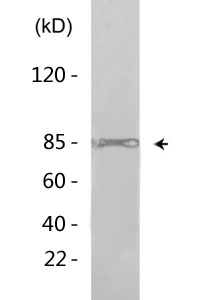 Catenin-β (phospho Ser37) Polyclonal Antibody