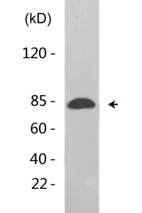 Catenin-β (phospho Thr41/S45) Polyclonal Antibody