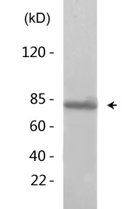 Cortactin (phospho Tyr421) Polyclonal Antibody