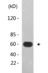 Dab1 (phospho Tyr232) Polyclonal Antibody