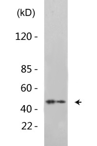 Dok-2 (phospho Tyr299) Polyclonal Antibody