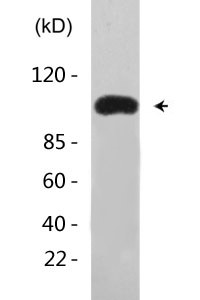 EF-2 (phospho Thr56) Polyclonal Antibody