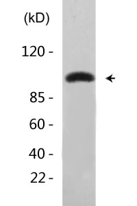 eEF2K (phospho Ser366) Polyclonal Antibody