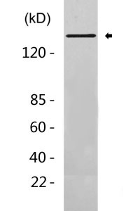 EGFR (phospho Ser1070) Polyclonal Antibody