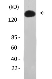 EGFR (phospho Thr678) Polyclonal Antibody