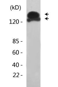 EGFR (phospho Thr693) Polyclonal Antibody