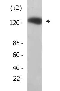 EGFR (phospho Tyr1092) Polyclonal Antibody