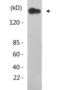 EGFR (phospho Tyr1110) Polyclonal Antibody