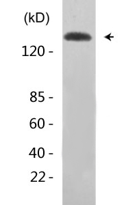 EGFR (phospho Tyr1172) Polyclonal Antibody