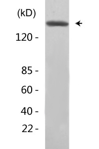 EGFR (phospho Tyr1197) Polyclonal Antibody