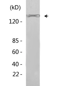 EGFR (phospho Tyr869) Polyclonal Antibody