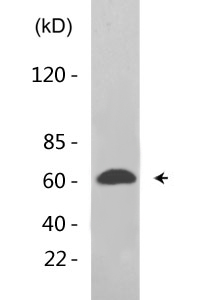 PKR (phospho Thr446) Polyclonal Antibody