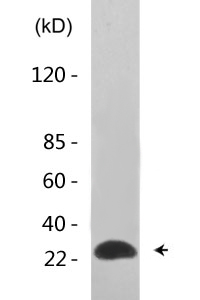 eIF4E (phospho Ser209) Polyclonal Antibody