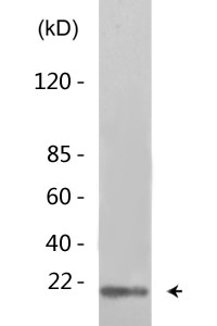 4E-BP1 (phospho Thr46) Polyclonal Antibody