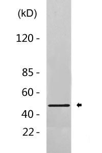 Elk-1 (phospho Ser383) Polyclonal Antibody