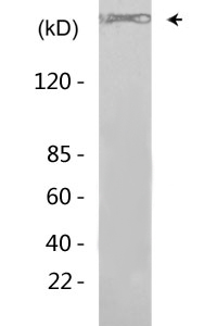 Filamin 1 (phospho Ser2152) Polyclonal Antibody