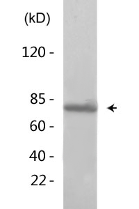 FoxO1 (phospho Ser319) Polyclonal Antibody