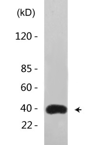 GATA-1 (phospho Ser142) Polyclonal Antibody