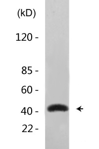 GATA-1 (phospho Ser310) Polyclonal Antibody