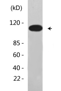 GluR-1 (phospho Ser863) Polyclonal Antibody