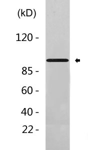 IGF-IR (phospho Tyr1161) Polyclonal Antibody