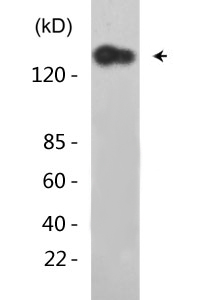 IGF-IR (phospho Tyr1165/Y1166) Polyclonal Antibody