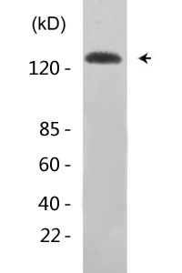 IRS-1 (phospho Ser307) Polyclonal Antibody