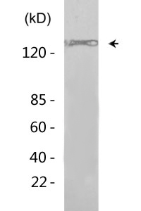 IRS-1 (phospho Ser636) Polyclonal Antibody