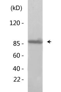 Integrin β3 (phospho Tyr785) Polyclonal Antibody