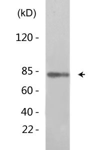 Tau (phospho Ser214) Polyclonal Antibody