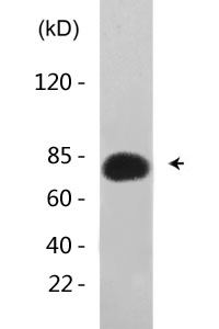 Tau (phospho Thr231) Polyclonal Antibody