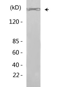 mTOR (phospho Ser2448) Polyclonal Antibody