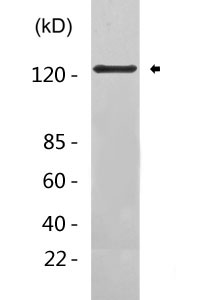 TRPA1 Polyclonal Antibody