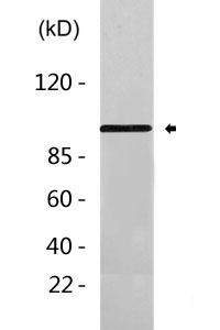 RBM10 Polyclonal Antibody