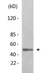 β I tubulin Monoclonal Antibody(3F7)