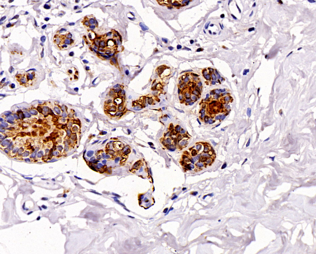 Mammaglobin抗体试剂（免疫组织化学）