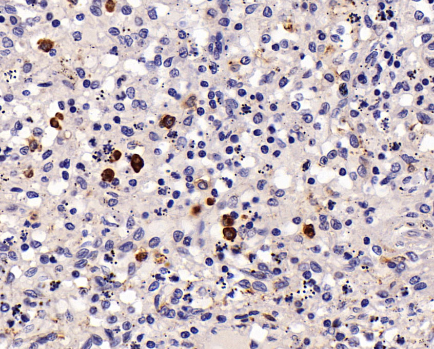 CD14抗体试剂（免疫组织化学）