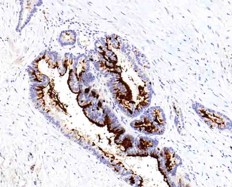 MUC5AC抗体试剂（免疫组织化学）
