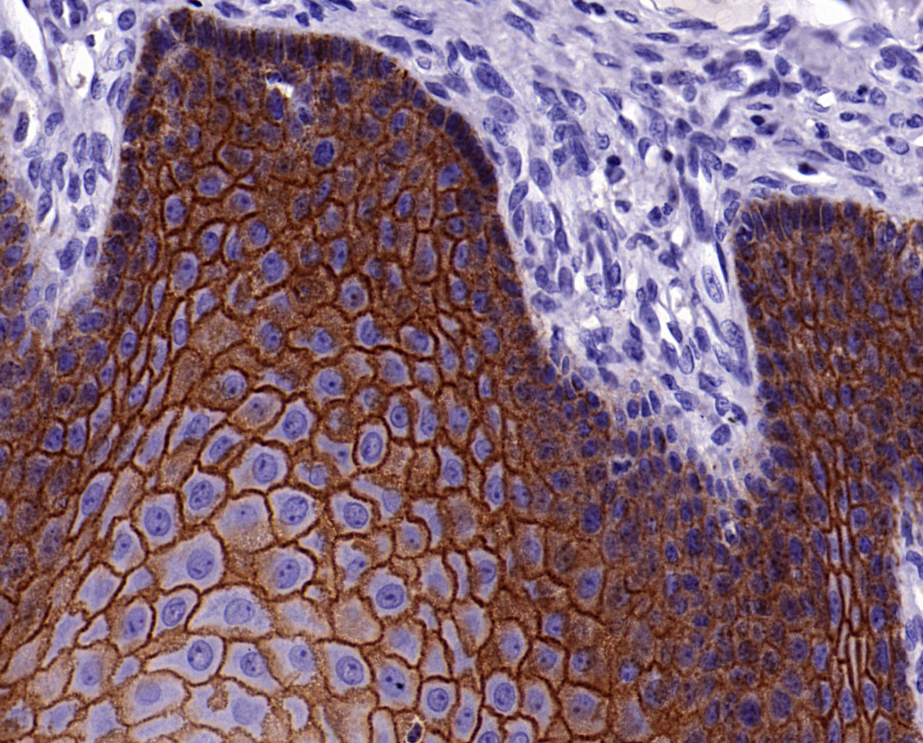 E-Cadherin 抗体试剂（免疫组织化学）