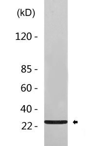 RFP Antibody