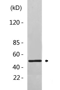 beta Tubulin Antibody (HRP conjugated)
