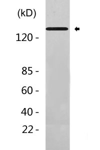 E Cadherin Antibody