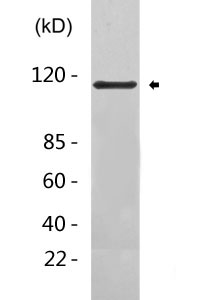 DSG1 Antibody