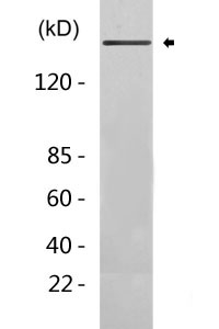 Topoisomerase II alpha Antibody