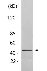 Cytokeratin 18 Antibody